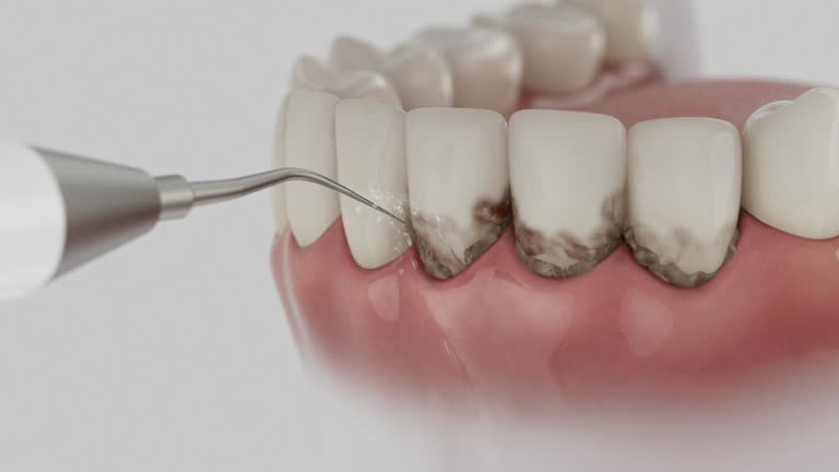 Reliable Dental Implants contractor in Mount Olive, IL by Smile Center Dentistry